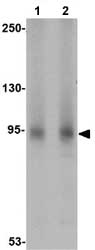 Western blot - Anti-AAK1 antibody (AB77082)