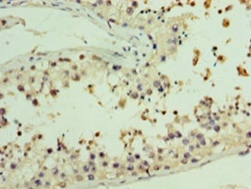 Immunohistochemistry (Formalin/PFA-fixed paraffin-embedded sections) - Anti-AASDHPPT antibody (AB235376)