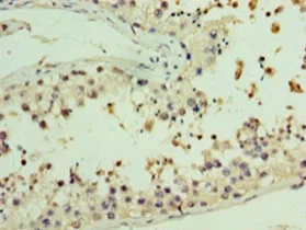 Immunohistochemistry (Formalin/PFA-fixed paraffin-embedded sections) - Anti-AASDHPPT antibody (AB235376)