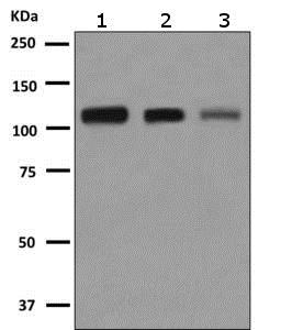 Western blot - Anti-AASS antibody [EPR9144] - BSA and Azide free (AB249052), expandable thumbnail