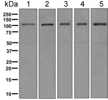 Western blot - Anti-AASS antibody [EPR9145(B)] - BSA and Azide free (AB249108)