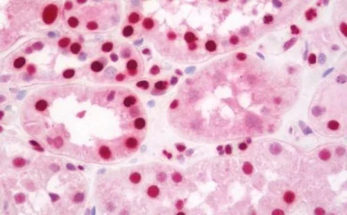 Immunohistochemistry (Formalin/PFA-fixed paraffin-embedded sections) - Anti-AATF/DED antibody [3C7] (AB219073)