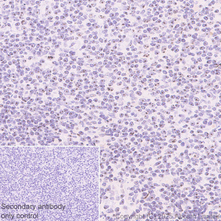 Immunohistochemistry (Formalin/PFA-fixed paraffin-embedded sections) - Anti-AATF/DED antibody [EPR30220-88] (AB325343)