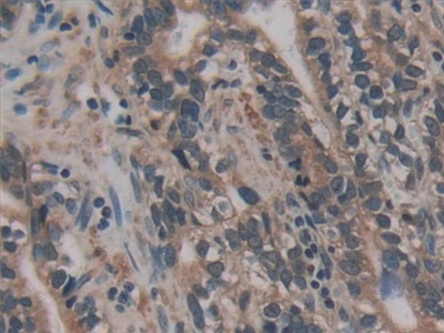 Immunohistochemistry (Formalin/PFA-fixed paraffin-embedded sections) - Anti-AATK antibody (AB231529), expandable thumbnail