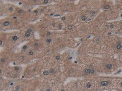 Immunohistochemistry (Formalin/PFA-fixed paraffin-embedded sections) - Anti-AATK antibody (AB231529), expandable thumbnail