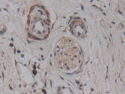 Immunohistochemistry (Formalin/PFA-fixed paraffin-embedded sections) - Anti-AATK antibody (AB231529), expandable thumbnail