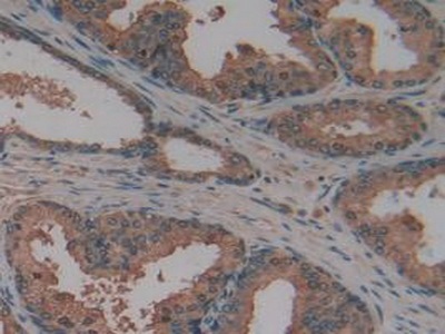 Immunohistochemistry (Formalin/PFA-fixed paraffin-embedded sections) - Anti-AATK antibody (AB231529), expandable thumbnail