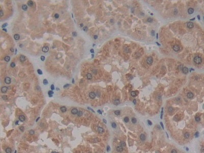 Immunohistochemistry (Formalin/PFA-fixed paraffin-embedded sections) - Anti-AATK antibody (AB231529), expandable thumbnail