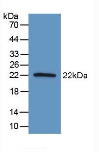 Western blot - Anti-AATK antibody (ab231529), expandable thumbnail