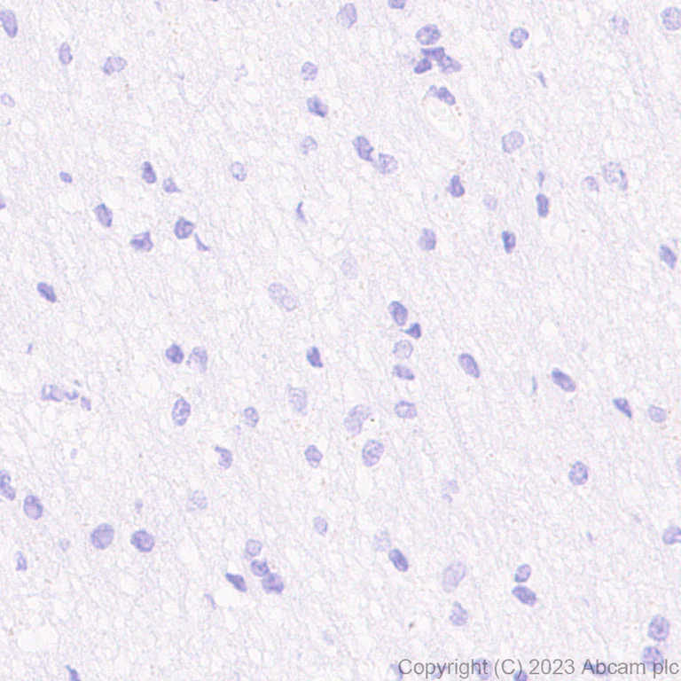 Immunohistochemistry (Formalin/PFA-fixed paraffin-embedded sections) - Anti-AAV2 Capsid protein VP1 antibody [EPR28595-59] (AB315287)