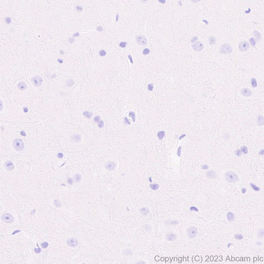 Immunohistochemistry (Formalin/PFA-fixed paraffin-embedded sections) - Anti-AAV2 Capsid protein VP1 antibody [EPR28595-59] - BSA and Azide free (AB315288), expandable thumbnail