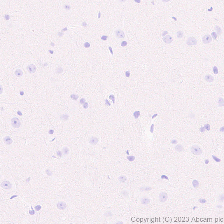 Immunohistochemistry (Formalin/PFA-fixed paraffin-embedded sections) - Anti-AAV2 Capsid protein VP1 antibody [EPR28595-59] - BSA and Azide free (AB315288)