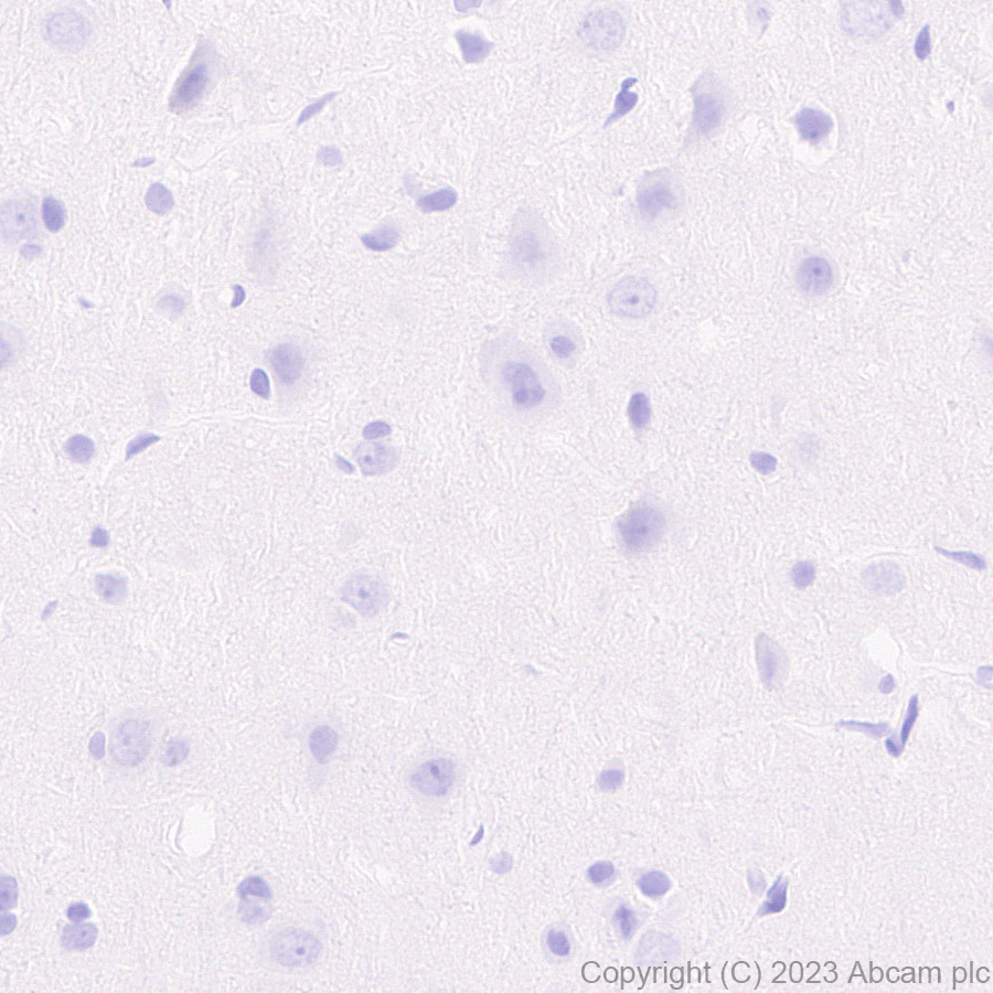 Immunohistochemistry (Formalin/PFA-fixed paraffin-embedded sections) - Anti-AAV2 Capsid protein VP1 antibody [EPR28595-59] - BSA and Azide free (AB315288), expandable thumbnail