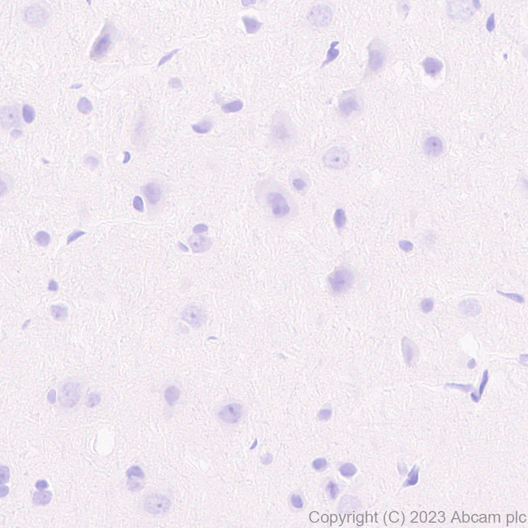 Immunohistochemistry (Formalin/PFA-fixed paraffin-embedded sections) - Anti-AAV2 Capsid protein VP1 antibody [EPR28595-59] - BSA and Azide free (AB315288)