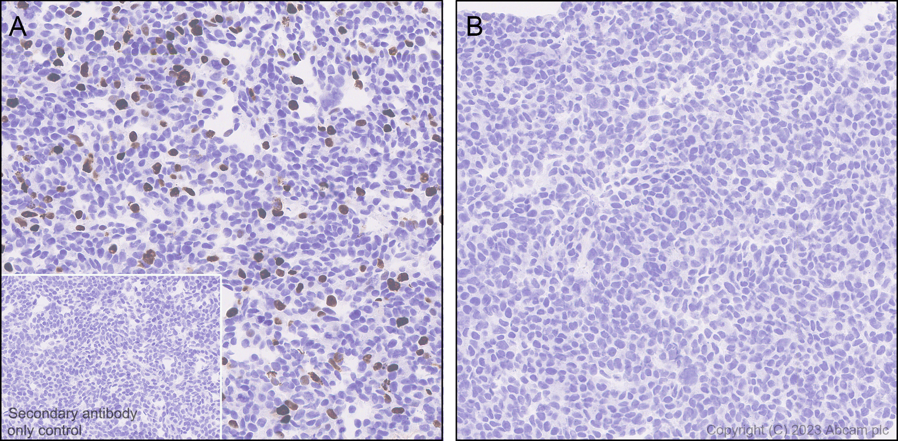 Immunohistochemistry (Formalin/PFA-fixed paraffin-embedded sections) - Anti-AAV2 Capsid protein VP1 antibody [EPR28595-59] - BSA and Azide free (AB315288), expandable thumbnail