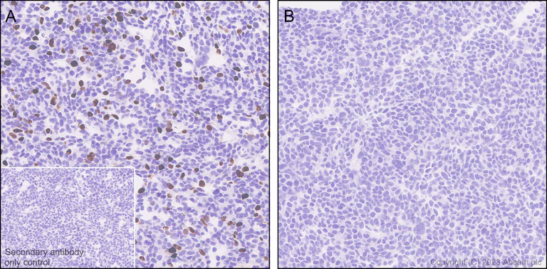 Immunohistochemistry (Formalin/PFA-fixed paraffin-embedded sections) - Anti-AAV2 Capsid protein VP1 antibody [EPR28595-59] - BSA and Azide free (AB315288)