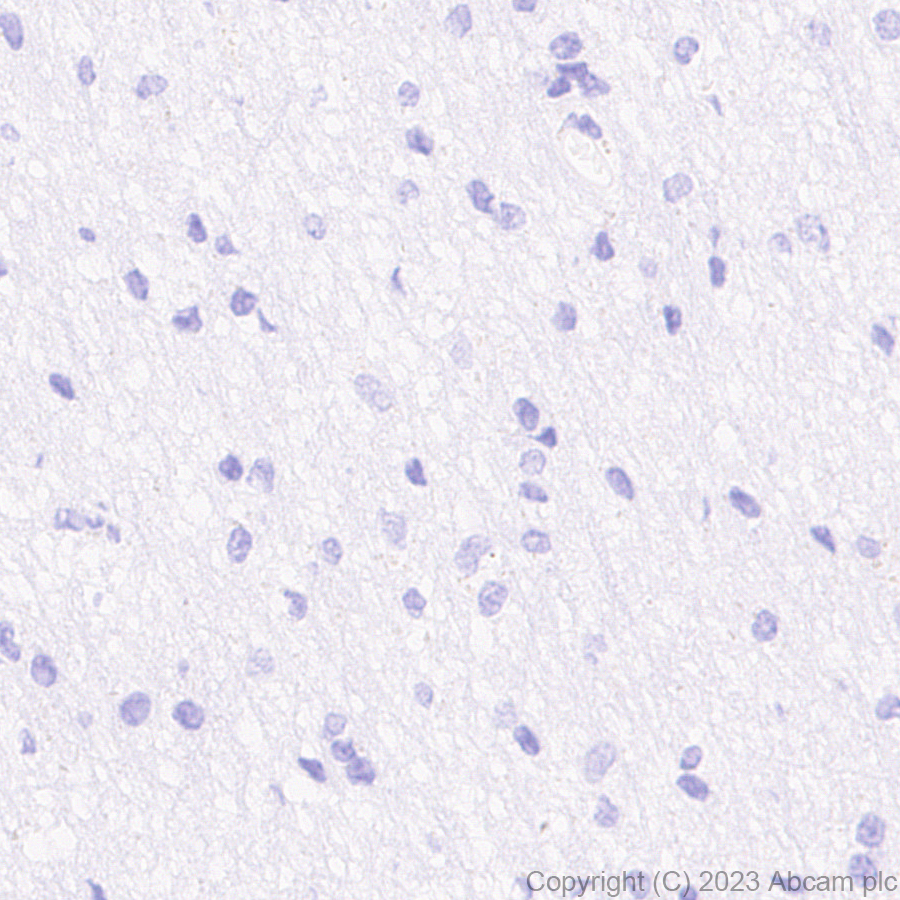 Immunohistochemistry (Formalin/PFA-fixed paraffin-embedded sections) - Anti-AAV2 Capsid protein VP1 antibody [EPR28595-59] - BSA and Azide free (AB315288), expandable thumbnail