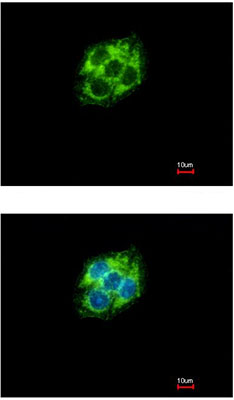 Immunocytochemistry/ Immunofluorescence - Anti-ABAT/GABA-T antibody (AB152134), expandable thumbnail