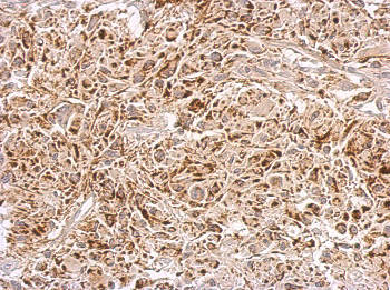 Immunohistochemistry (Formalin/PFA-fixed paraffin-embedded sections) - Anti-ABAT/GABA-T antibody (AB152134), expandable thumbnail