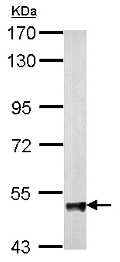 Western blot - Anti-ABAT/GABA-T antibody (AB152134), expandable thumbnail