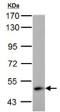 Western blot - Anti-ABAT/GABA-T antibody (AB152134), expandable thumbnail