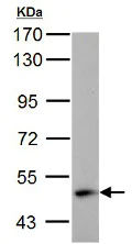 Western blot - Anti-ABAT/GABA-T antibody (AB152134)