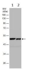 Western blot - Anti-ABAT/GABA-T antibody (AB152134)