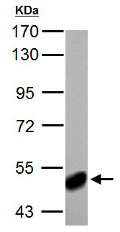 Western blot - Anti-ABAT/GABA-T antibody (AB152134), expandable thumbnail