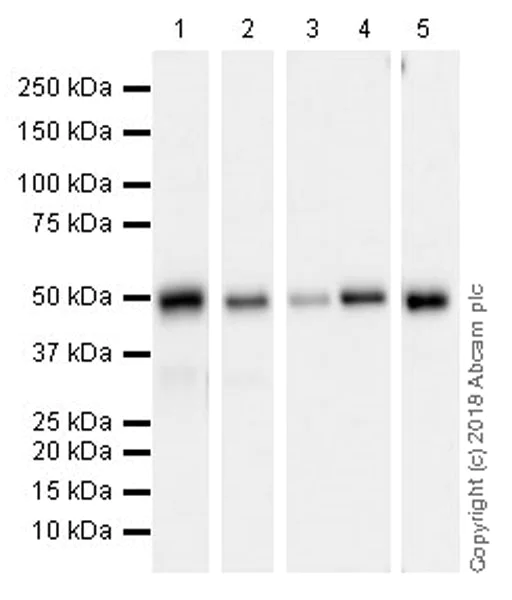 Western blot - Anti-ABAT/GABA-T antibody [EPR20842] (AB216465)
