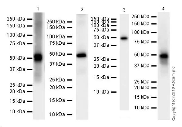 Western blot - Anti-ABAT/GABA-T antibody [EPR20842] (AB216465)