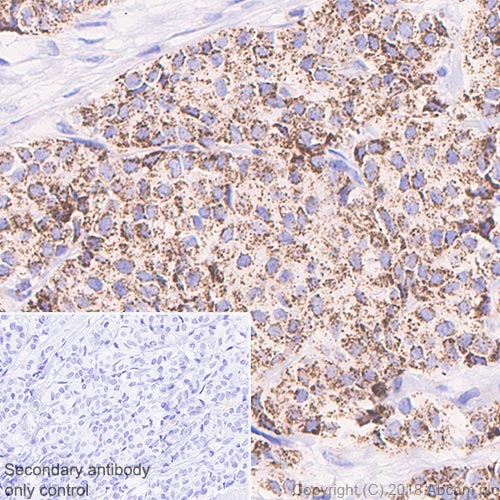 Immunohistochemistry (Formalin/PFA-fixed paraffin-embedded sections) - Anti-ABAT/GABA-T antibody [EPR20842] - BSA and Azide free (ab233702), expandable thumbnail