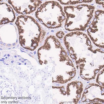 Immunohistochemistry (Formalin/PFA-fixed paraffin-embedded sections) - Anti-ABAT/GABA-T antibody [EPR20842] - BSA and Azide free (ab233702), expandable thumbnail