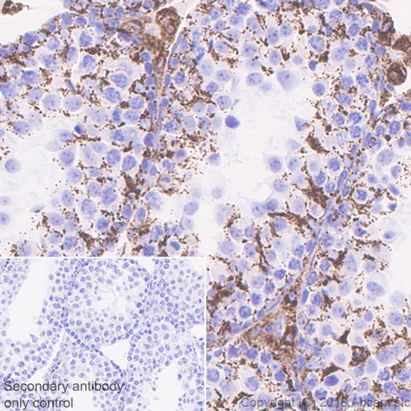 Immunohistochemistry (Formalin/PFA-fixed paraffin-embedded sections) - Anti-ABAT/GABA-T antibody [EPR20842] - BSA and Azide free (ab233702), expandable thumbnail