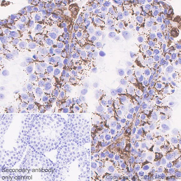 Immunohistochemistry (Formalin/PFA-fixed paraffin-embedded sections) - Anti-ABAT/GABA-T antibody [EPR20842] - BSA and Azide free (AB233702)