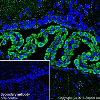 Immunohistochemistry (Frozen sections) - Anti-ABAT/GABA-T antibody [EPR20842] - BSA and Azide free (ab233702), expandable thumbnail
