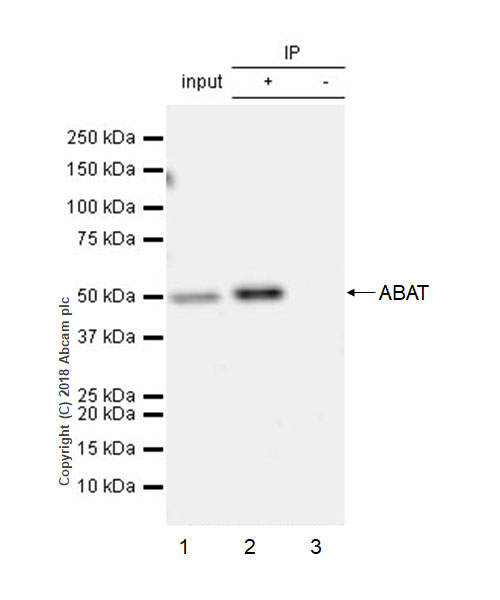 Immunoprecipitation - Anti-ABAT/GABA-T antibody [EPR20842] - BSA and Azide free (AB233702), expandable thumbnail