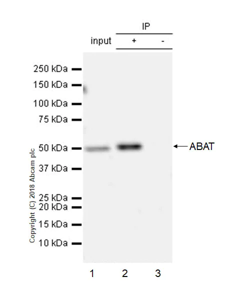 Immunoprecipitation - Anti-ABAT/GABA-T antibody [EPR20842] - BSA and Azide free (AB233702)