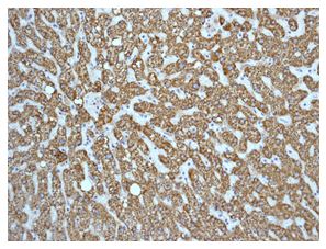 Immunohistochemistry (Formalin/PFA-fixed paraffin-embedded sections) - Anti-ABAT/GABA-T antibody [EPR4433] (AB108249)