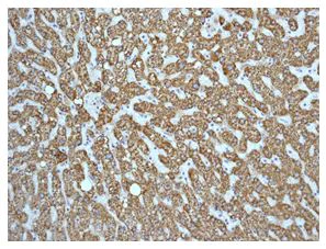 Immunohistochemistry (Formalin/PFA-fixed paraffin-embedded sections) - Anti-ABAT/GABA-T antibody [EPR4433] (AB108249)