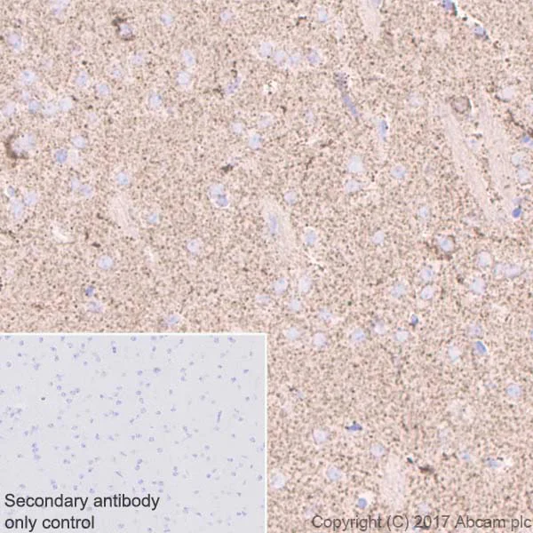 Immunohistochemistry (Formalin/PFA-fixed paraffin-embedded sections) - Anti-ABAT/GABA-T antibody [EPR4433] (AB108249)