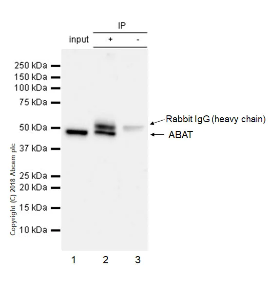 Immunoprecipitation - Anti-ABAT/GABA-T antibody [EPR4433] (AB108249)