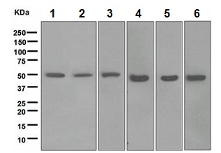 Western blot - Anti-ABAT/GABA-T antibody [EPR4433] (AB108249)
