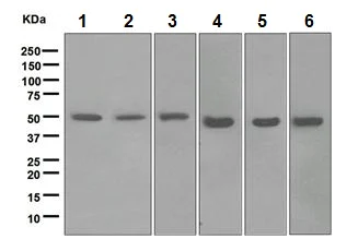 Western blot - Anti-ABAT/GABA-T antibody [EPR4433] (AB108249)