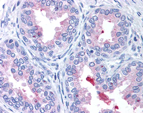 Immunohistochemistry (Formalin/PFA-fixed paraffin-embedded sections) - Anti-ABCA1 antibody (AB7360)