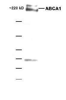 Western blot - Anti-ABCA1 antibody (AB7360)
