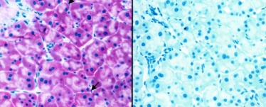 Immunohistochemistry (Formalin/PFA-fixed paraffin-embedded sections) - Anti-ABCA1 antibody [AB.H10] (AB18180), expandable thumbnail