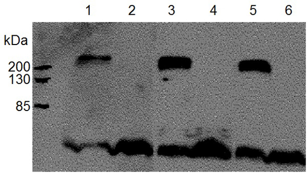 Western blot - Anti-ABCA1 antibody [AB.H10] (AB18180), expandable thumbnail