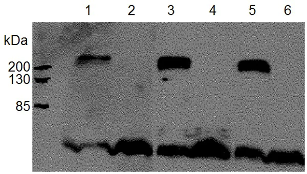 Western blot - Anti-ABCA1 antibody [AB.H10] (AB18180)