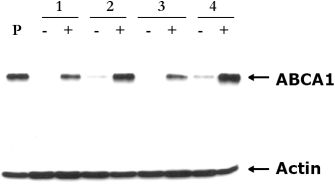 Western blot - Anti-ABCA1 antibody [AB.H10] (AB18180), expandable thumbnail