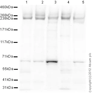 Western blot - Anti-ABCA1 antibody [HJ1] (AB66217)